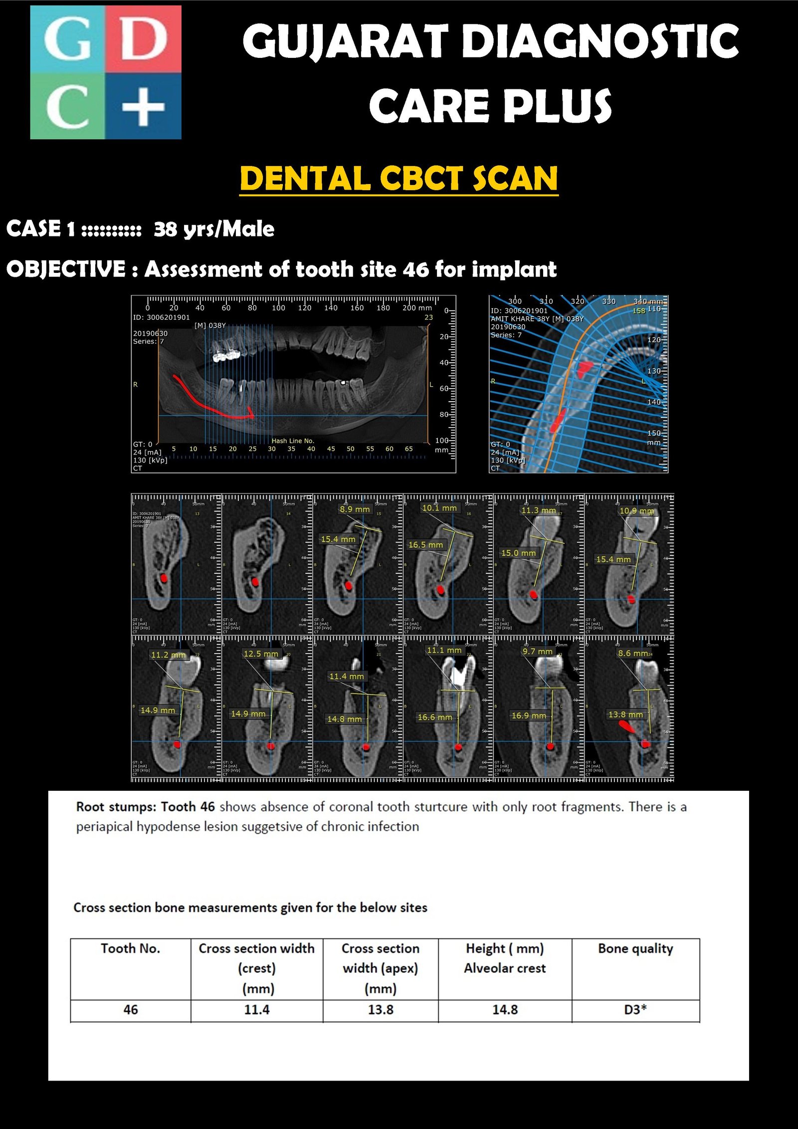 32-Slice CT Scan