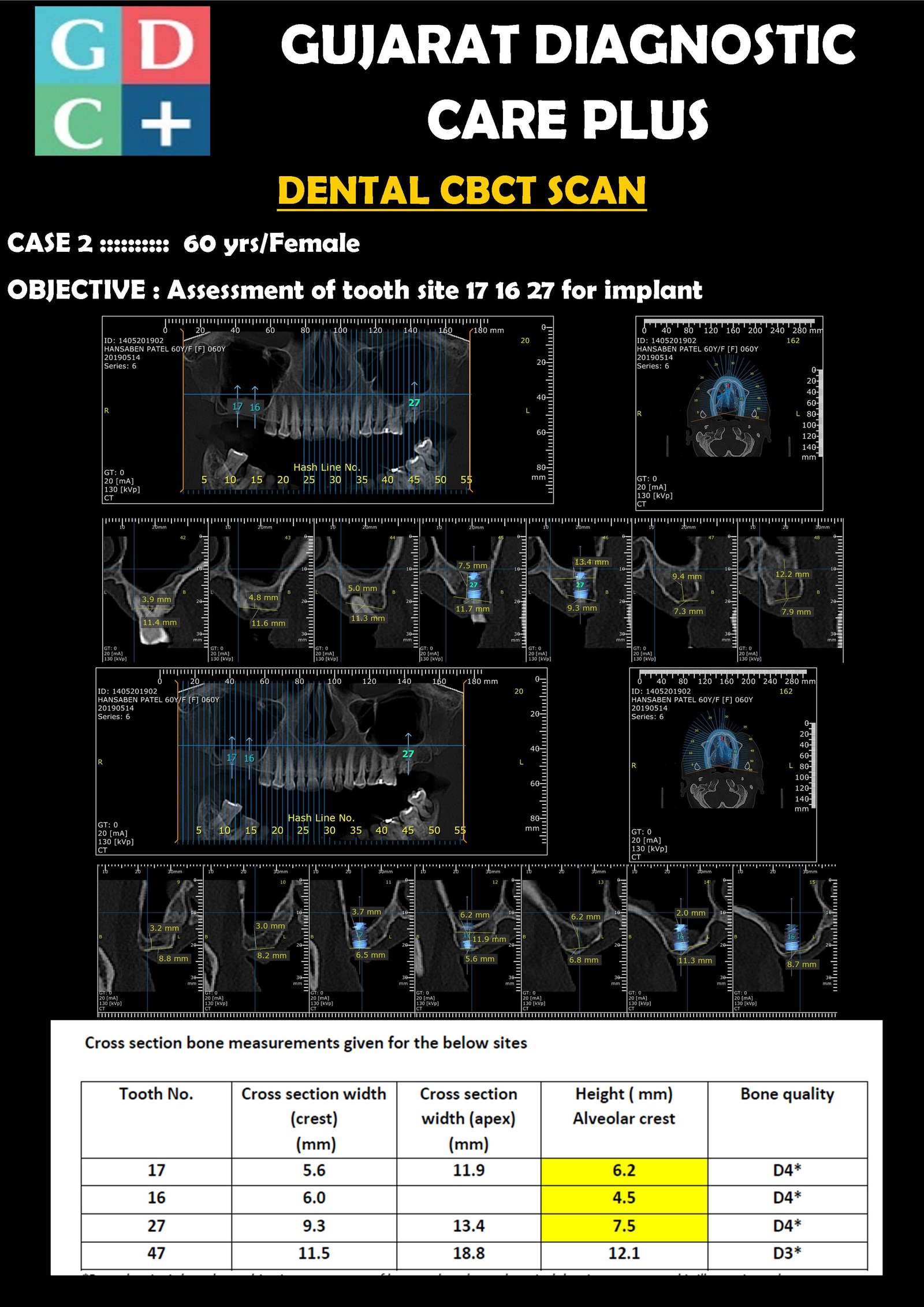 32-Slice CT Scan
