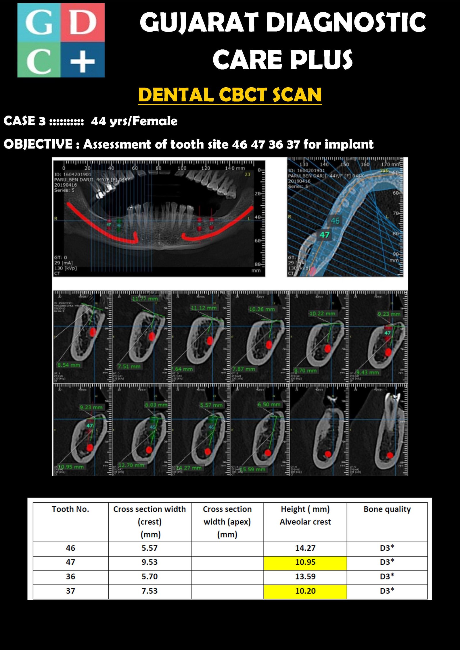 32-Slice CT Scan