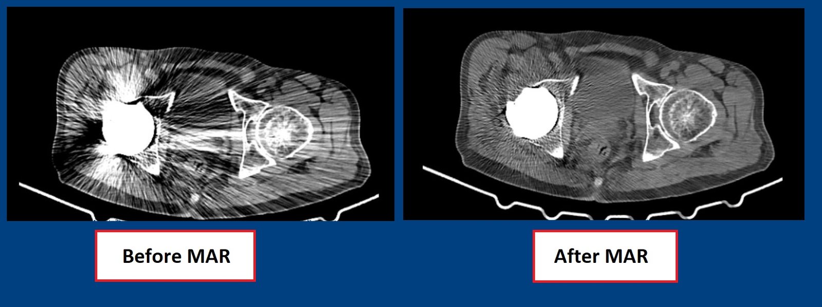 32-Slice CT Scan