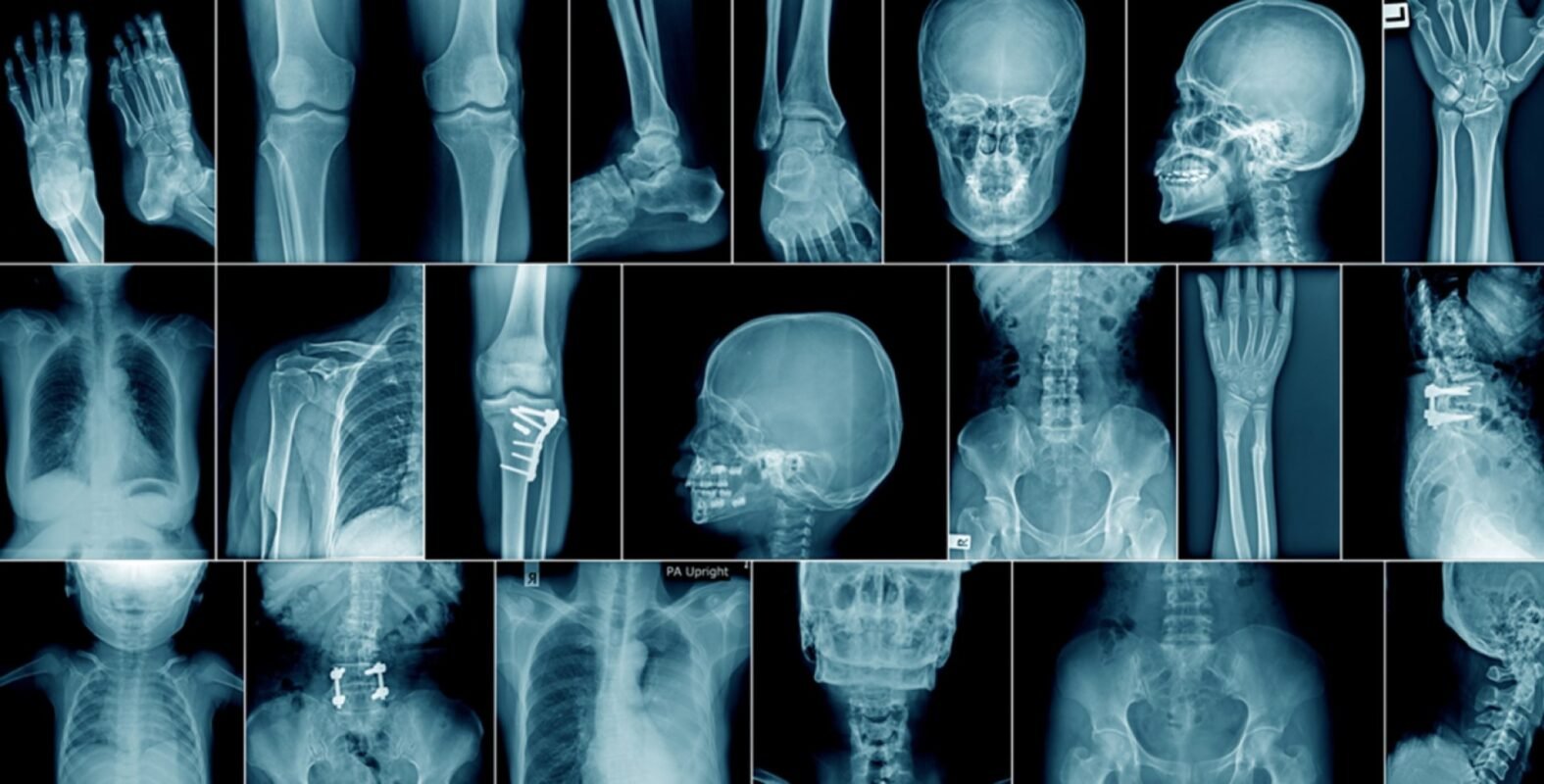XRAY in slider image
