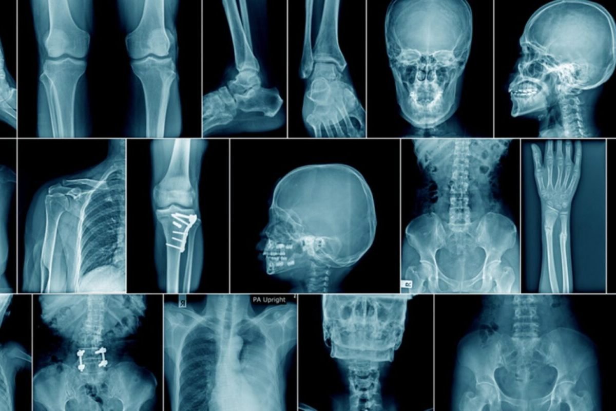 XRAY in slider image